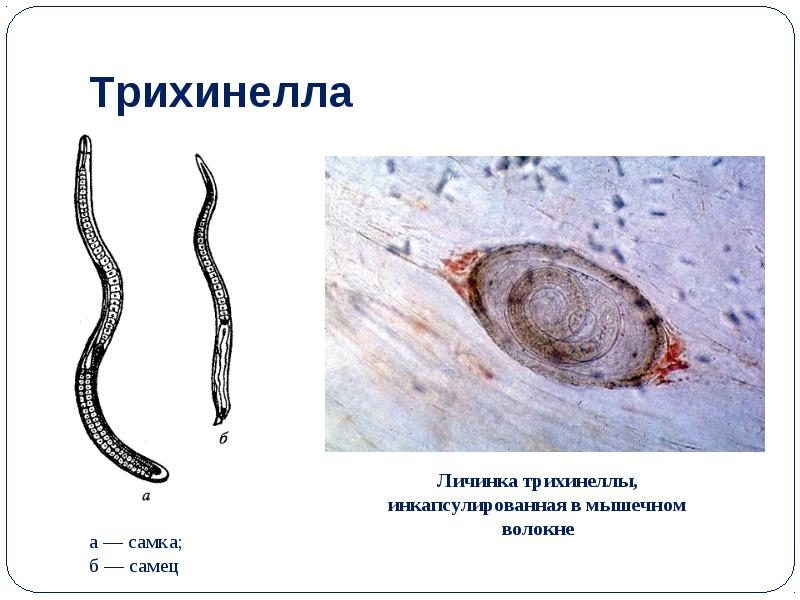 Черви в рыбе: виды гельминтов и их опасность